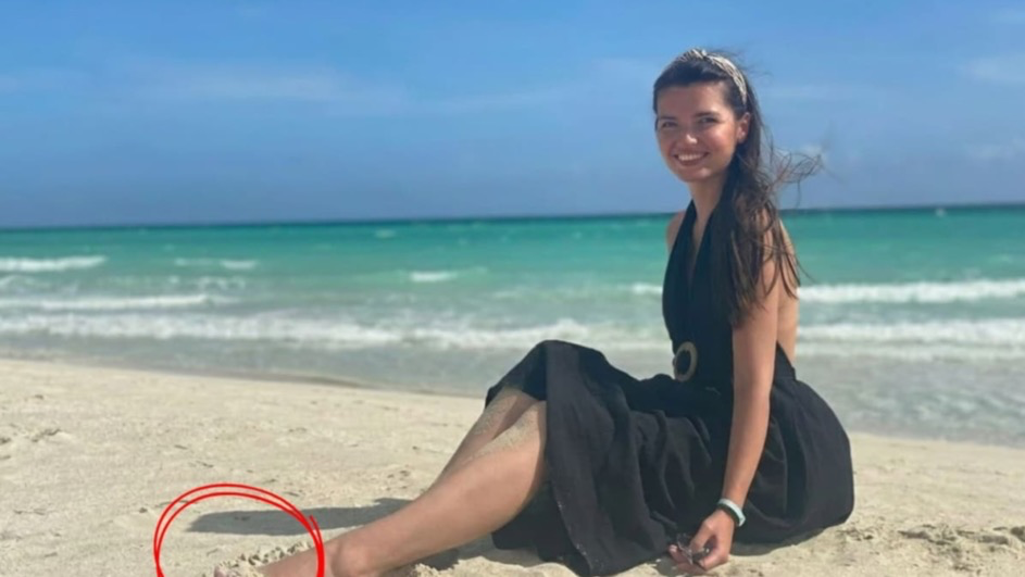 Frau in einem schwarzen Kleid sitzt am Strand; ihr Fuß ist rot markiert